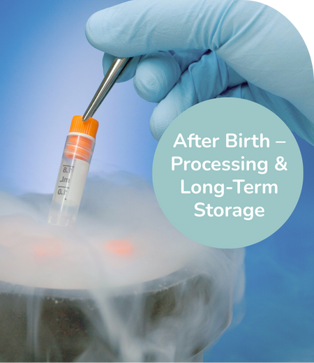 Stem Cell Sample Stored in a Liquid Nitrogen Tank