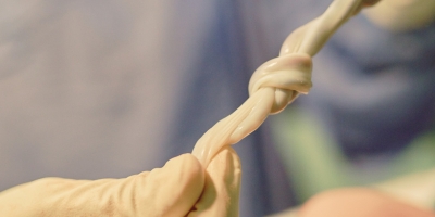Umbilical Cord Tissue