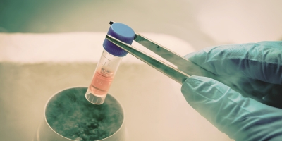 Exosomes