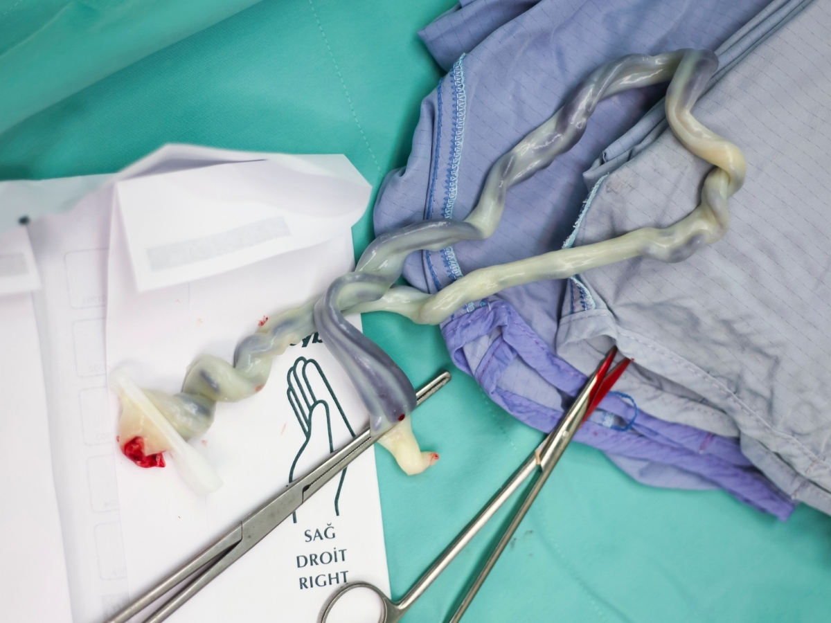 Delayed Cord Clamping at Birth